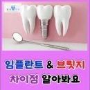 걸포탑치과의원 네이버블로그