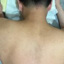 이건업한의원 | 강남 등드름 한의원 : 내돈내산 한의원 방문기 2탄