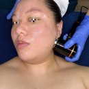 큐어핏 | 이대피부관리 ㅣ 큐어에스테틱 마포이대점 페이스핏톡스 수분충전 피부탄력관리 후기