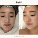 분당 정자 피부관리 올뉴뷰티 시그니처관리 모공+복부 관리 대만족 후기!