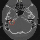 구(고경) 이미지
