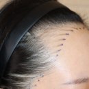 움찬의원 이미지