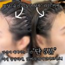 브라운메디컬 | 파주미용실추천 아이디헤어 운정목동점 애쉬브라운 염색 후기