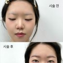 눈썹