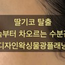 피부나라물광공주