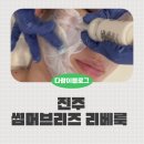 리베 | 진주 초전동에스테틱 썸머브리즈 리베룩관리 솔직후기