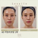 레젤스킨 & 바디