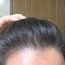 기가슬라임 | 바이브랩 홍현희 샴푸 앰플 탈모인 내돈내산 2주 후기