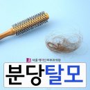 분당탈모 탈출을 위한 방법을 제시해드리는 이미지