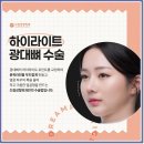 광대 | 광대축소술후기 찾아보며 고민 중일 때 참고할 것들