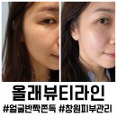 창원 피부관리 잘하는 곳, 올래뷰티라인 수분,화이트닝 관리 후기
