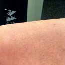 신비의료기 이미지