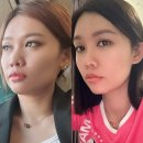 시드니유통 | 호주주름크림 미라클시드니 효과 후기