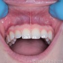 나란이치과의원 네이버블로그