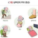 심부전 증상 원인 치료 울혈성 심부전증 (호흡곤란 부종) 이미지