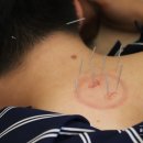 사랑방한의원 이미지