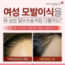 에이스 헤어라인