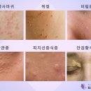 올리본의원 이미지