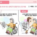 올해 달라지는 장애인정책 총정리장애수당 인상, 노인성 65세 미만 활보 허용 이미지