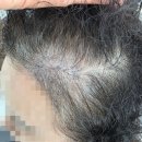 양덕동202 | 양덕동미용실 [MH헤어 마산양덕동] 60대 엄마가 직접 다녀온 두피관리 상담 후기