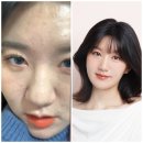 디톡스라이프 | 4라이프 디톡스 다이어트 후기