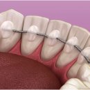 에이플러스치과의원 | 서대문구교정치과 추천 병원 리스트 찾고 있다면? 그 전에 ‘이것’ 따지세요