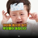 제이메드 | 우리 아이 감기인 줄 알았는데 중이염이었습니다… 시작은 "이 습관"