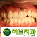 허브치과 이미지