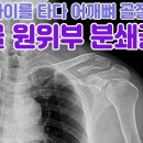 리더스정형외과 네이버블로그