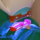 청담에이치치과의원 이미지