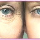 화이트피부관리실 이미지