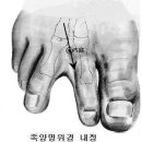 림린