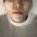 병점피부관리 솔에스테틱 대표원장 여드름관리 후기