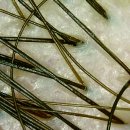 허브디톡스 이미지