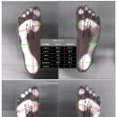 다나아짐 운동재활센터 | 다나아짐 재활치료 후기