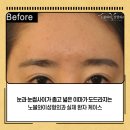 노블와이성형외과의원 이미지