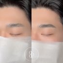 비프리티 이미지