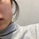 안아픈세상한의원 | 아름턱한의원 비대칭 턱관절치료 내돈내산 3회차 약실 멍 후기