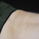 청량리한의원 이미지