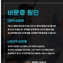 엘앤케이미래건강 | 비문증 비문증 치료 눈 지렁이 눈 앞에 지렁이 비문증 증상 원인 비문증 안과 비문증 영양제(내돈내산)