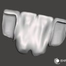 FIT치과기공소 이미지