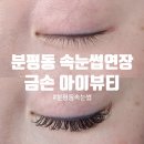 금손아이뷰티