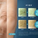 뉴스킨 웰스파 효과 없다던 사람도 계속 쓰는 이유!!