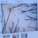 닥터포헤어(잠실점) | 송파두피 닥터포헤어 송파잠실점 두피관리 자세한 후기