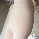 백운초등학교 | 대전여드름압출, 괴정동 피부관리 리브온에스테틱 색소침착에 좋은 원데이필 후기