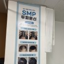 상계평생건강관리센터 | 노원 상계역 가르마 두피 커버 SMP 인블랙디자인센터 엄마 3회차 리얼 후기