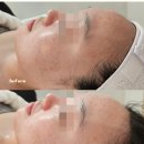 나를 만나는 시간 | 부산에스테틱 사직동 나를만나는시간 맞춤동안관리 후기
