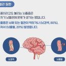 겨울이면 부쩍 늘어나는 뇌졸중…추위 보다 ‘이것’ 영향이 크다는데 [동인보감] 이미지