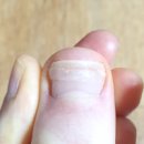 닥터아이티엔_로다살롱