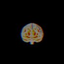 엑스포제일의원 이미지